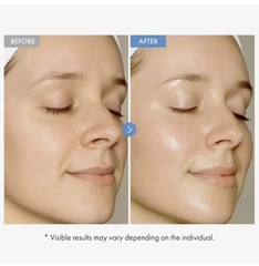 2 PCK-Arbutin7% Tranexamic Acid 4% Cream 50ml Brightening K Beauty FREE SHIP