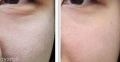 STEM CELLS COPPER PEPTIDE SERUM