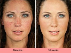 DARK SKIN WHITENING LIGHTENING ULTRA BRIGHTENING SERUM Dark Spot Bleaching Cream