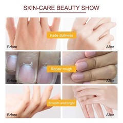 5 Pairs Hand Mask Gloves, Moisturizing & Repairing Treatment for Extra Dry & Rou