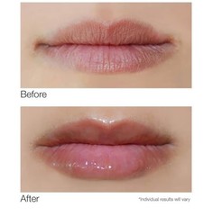 Dermelect Smooth Lip Volumizing Plumping Gloss Oil Professional Treatment Cream