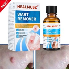 HEALMUSZ Verruca Removal Potion 30ML Skin Tag Remover Equipped Natural Herbal