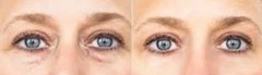 Eye Serum