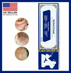 SKIN OINTMENT BODY PSORIASIS DERMATITIS ECZEMA NATURAL TREATMENT CREAM 15G