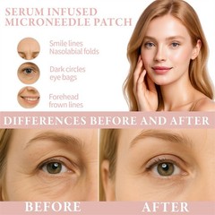 3X Micro-needle Eye Patch Remove Acid Anti-wrinkle Eye Mask Hyaluronic Fine Line