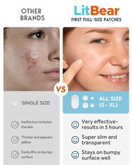 LitBear Large Acne Pimple Patches, 5 Sizes 80 Count (Pack of 1), Transparent