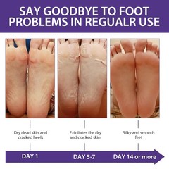 2/6/12 Pairs Exfoliating Foot Peel Mask Baby Soft Feet Remove Dead Skin Calluses