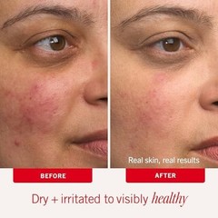 Face Moisturizer Cream Intense Hydration Colloidal Oatmeal Fragrance Free Dry