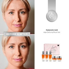 NEW Inner Cells Hyaluronic Acid Age Face Neck Skin Age Defying