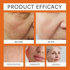 VLSVLS Bee Venom skin Treatment Cream, Improved Firming & Wrinkle-Reducing cream
