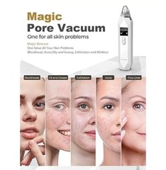 Blackhead Remover Electric Pore Nose Sucker Pimple Skin Acne Face Cleaner-Vacuum