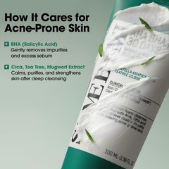 SOME BY MI AHA BHA PHA 30 Days Miracle Acne 3.38 Fl Oz (Pack of 1), Pack 1