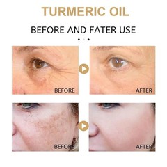 2 Pack Turmeric Oil, Natural Turmeric Oil Serum for Face,Skin Care Moisturizing