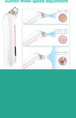 Wireless Visual Blackhead Remover Vacuum – 1080P HD Camera Pore Cleaner – USA