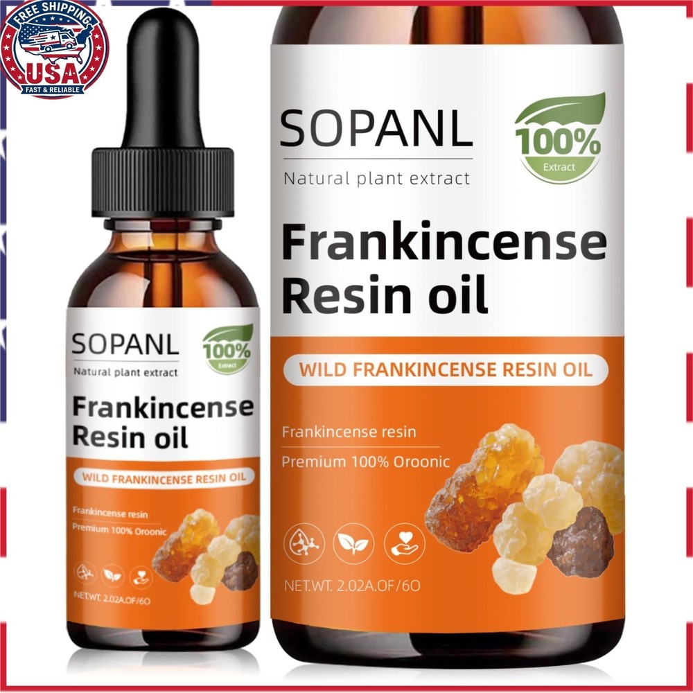 Organic Frankincense Resin Oil – Reduces Fine Lines & Wrinkles 2 Fl Oz