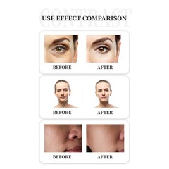 Pro 7 Colors BIO PDT LED Light Facial Skin Rejuvenation Photon Therapy Machine