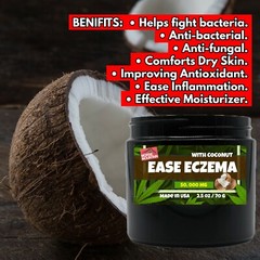 Hempseed Psoriasis Eczema cream, Dermatitis, Dry Skin Care flareups Anti Itch 