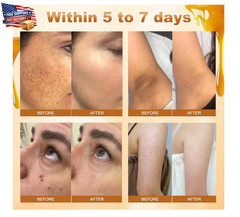 Bee Venom All-In-One Cream Skin Treatment 2026 Professional Bee Venom Cream 60g