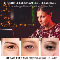 Eye Cream Instant Remove Eye Bags Dark Circles Anti Wrinkle Depuffing Firming