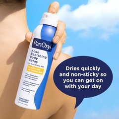 PanOxyl Acne Banishing Body Spray with 2% 6 Ounce (Pack of 1), White