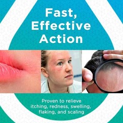 Seborrheic Dermatitis Cream, Eczema Cream, Fast-Acting Itchy Skin Relief, Eases