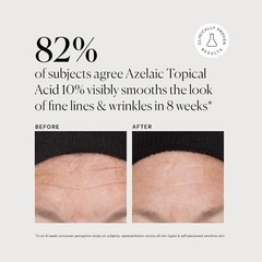 Naturium Azelaic Acid 10% Serum – 1 oz, with Niacinamide & Vitamin C