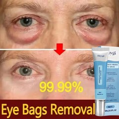 Under Eye Cream Remove Dark Circles Bags Face Lines Ageless Wrinkles Puffy Eye~