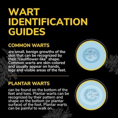 Dr. Scholl&rsquo;s Freeze Away MAX Skin Tag Wart Remover Fastest Treatment 10 Count