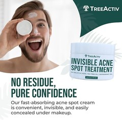 Salicylic Acid Cystic Acne Spot Treatment, 0.5 Fl Oz, Acne Treatment for Face…