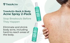 TreeActiv Salicylic Acid Back & Body Acne Spray Shrinks Body Acne 4 fl oz 2pack