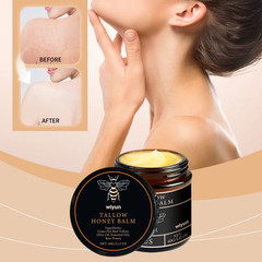 Grass Fed Beef Tallow Honey Balm Organic Raw Unscented Skin Moisturizer (3 pcs )