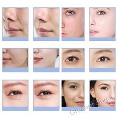 Glam Pod Aqua Facial Beauty CO2 Pods Bubble Revive Pods Capsule Gels Face SPA US