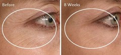 Coq10 Serum Resveratrol Alpha Lipoic Acid Argan Oil Vitamin C and E Anti Aging