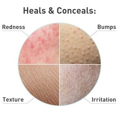 Travel-Friendly Rosacare Hydrogel – 2 Fl Oz Face Moisturizer for Rosacea Relief