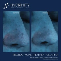 PRELUDE Facial Treatment Cleanser-cleanse away makeup, excess oils,impurities.