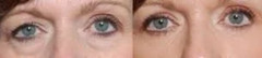 Eye Serum