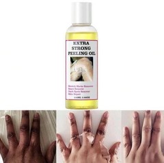 Peeling Oil 110mL Salicylic Acid Exfoliating Face/Body Dark Spots & Scars