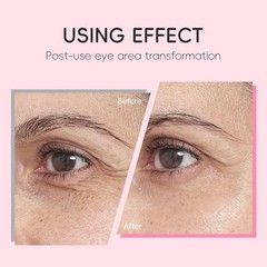 2-in-1 Sakura Eye Serum and Eye Roller, Eye Massager Roller Lifting, Eye Crea…