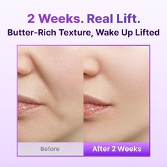 3D Lifting Cream for Face & Neck | Korean Night Cream