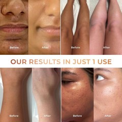 NICONI Tan Vanish Gluta-Kojic Skin Polish 180g Instant Tan Removal For All Skin