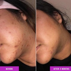 Good Molecules Discoloration Correcting Serum Tranexamic Acid Ester Salt