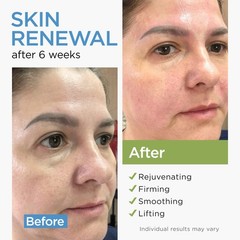 Moisturizer Collagen AntiAging Face Cream with Stem Cells, Retinol, Hyaluroni…