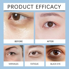 Under Eye Cream Remove Dark Circles Bags Face Lines Ageless Wrinkles Puffy Eye~