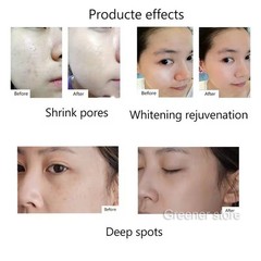 9/12/24/36/42 Pins Nano Tips Micro Pen Wrinkle Remove Skin Rejuvenation Machine