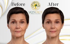 Collagen Boost Hydro Glo Jelly Mask PeelOff Vajafacial Mask All Skin 30oz 12 Apl