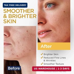 Vitamin C Serum for Face with Stem Cells Hyaluronic Acid Vitamin E Aloe Vera Ant