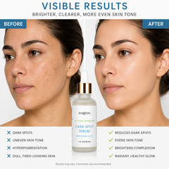 Evagloss Dark Spot Serum with Kojic Acid 1oz Natural Skincare Brightening Serum