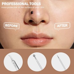 Blackhead Remover Pimple Popper Tool Kit 6 Pcs wan-6-piece, Silver