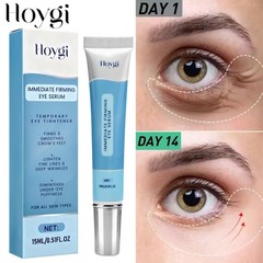 Under Eye Cream Remove Dark Circles Bags Face Lines Ageless Wrinkles Puffy Eye~
