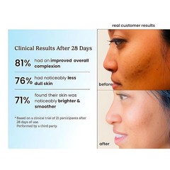 Timeless 20% Vitamin C + E Ferulic Acid Serum 1oz (30 ml) brightens corrects